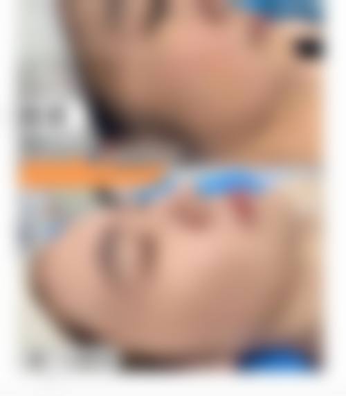 八、釜山DH整形外科医院预约方式