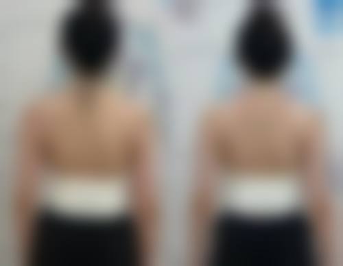 九、上海新极点医疗美容诊所真实的患者评价