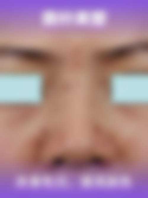 九、长春南关海茵整形医院真实的患者评价