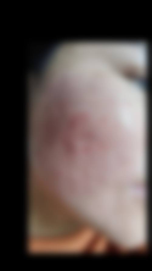 八、临汾现代女子医院整形美容中 心真实的患者评价