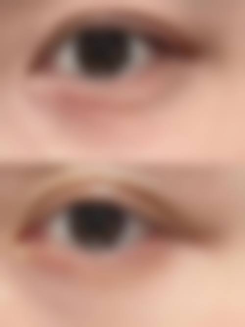 四、北京中韩合生缘整形医疗美容门诊部特色项目