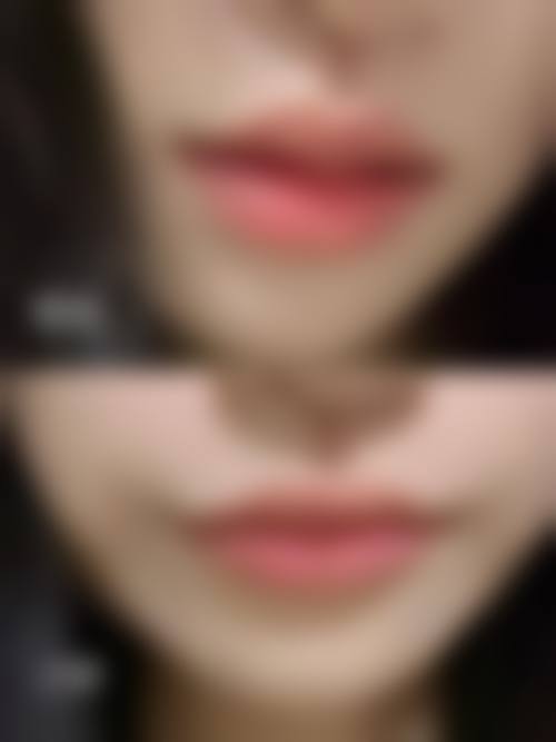 六、天津伊颂整形美容医院价格表