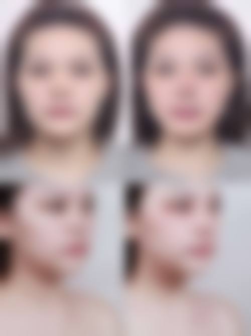 二、山东皮肤病性病防治研究所激光美容整形外科怎么样?