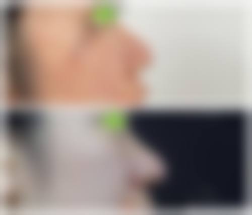 六、成都蕴禅医疗美容门诊部价格表