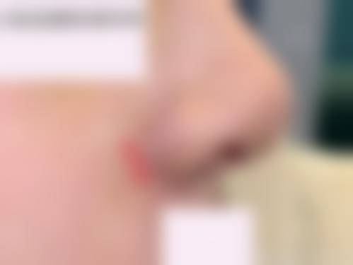 六、山东皮肤病性病防治研究所激光美容整形外科价格表