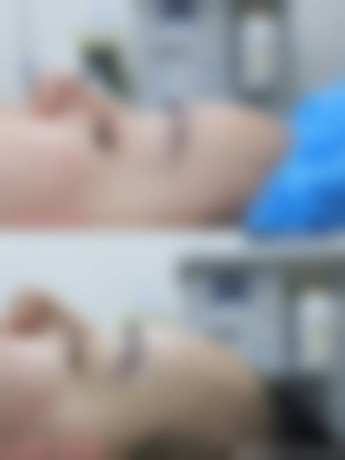 四、湛江赤坎童妍医疗美容诊所特色项目