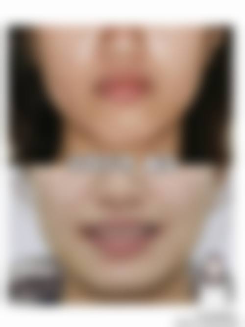 八、安顺赫尔美整形医院真实的患者评价