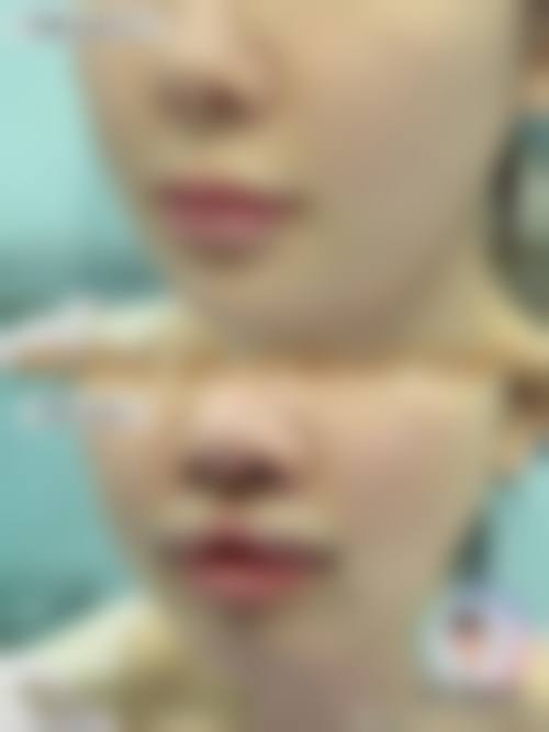 八、天津伊颂整形美容医院预约方式