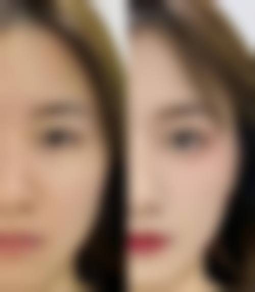 五、合肥崔劲松微创医疗美容门诊部医生介绍