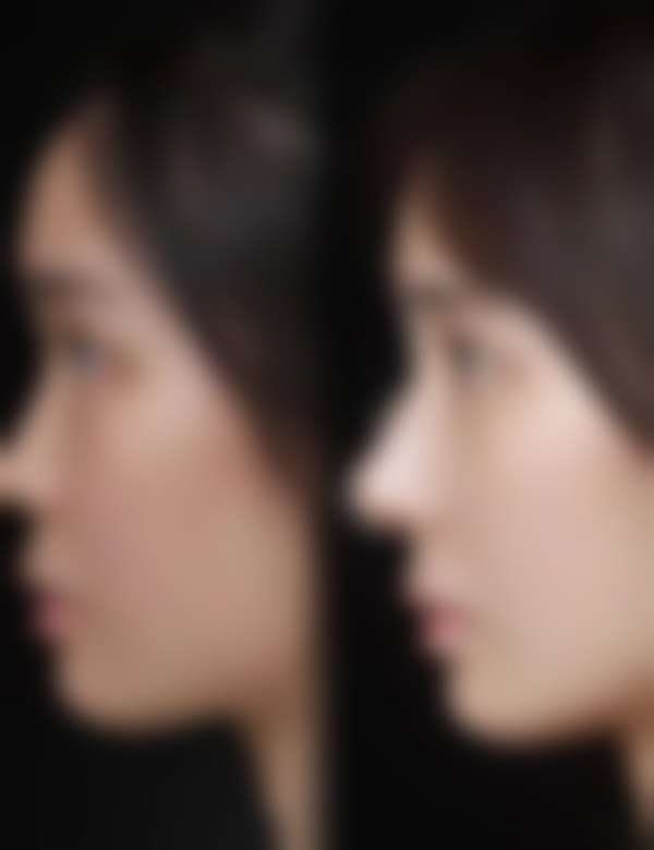 二、烟台鹏爱整形美容医院门诊部怎么样?