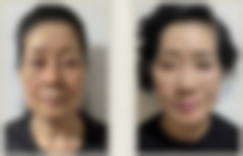 五、兰州雅森医疗美容门诊部价格表