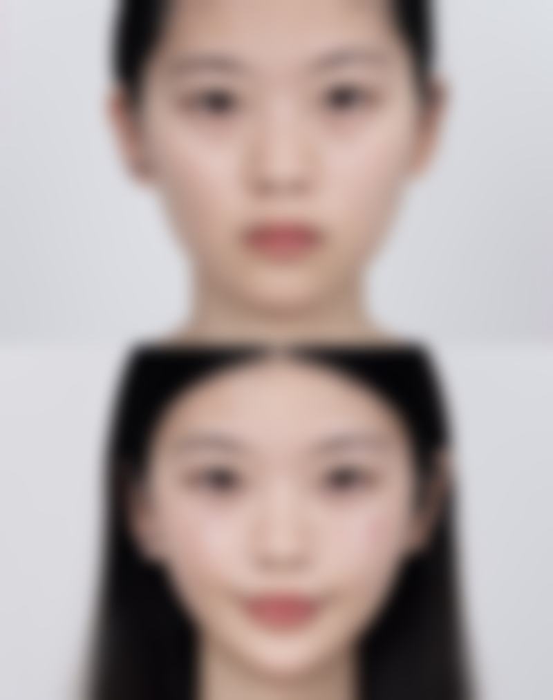 四、做了双眼皮手术,运动方面的注意事项