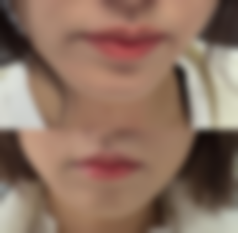 八、广安悦她婕熹卡医疗美容诊所预约方式