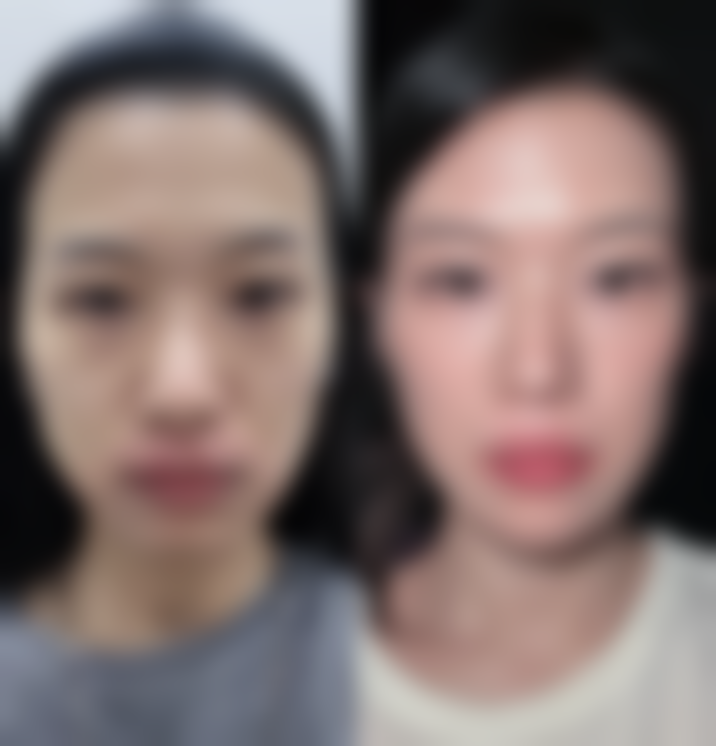 四、医美干预选择