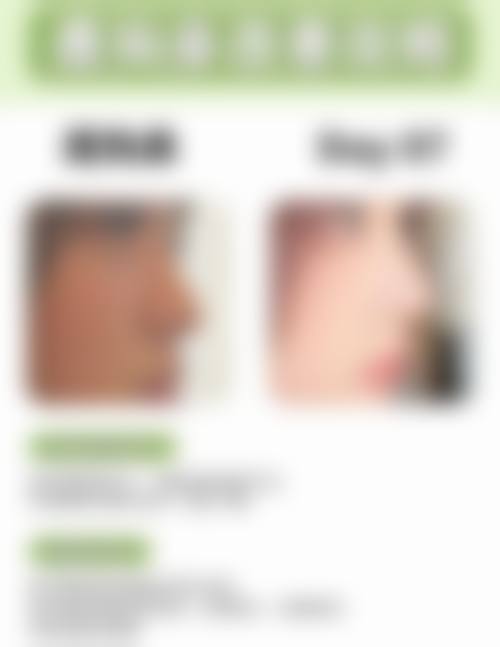 六、重庆颜轻医疗美容价格表