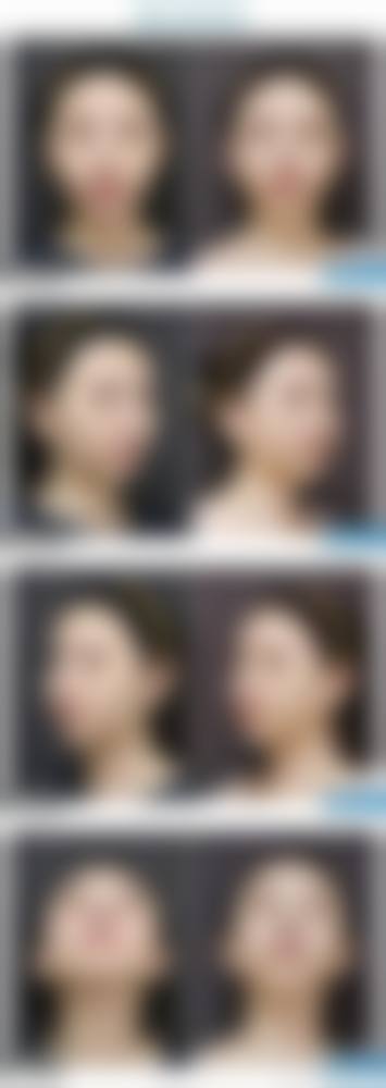 三、济南伊美尔加禾植发连锁机构诊疗项目有哪些?