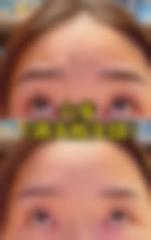 九、江苏苏州柏达丽医疗美容真实的患者评价