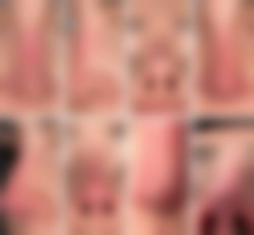 九、韩国清潭NB整形外科真实的患者评价