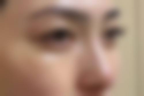 三、青岛市立整形医院诊疗项目有哪些？