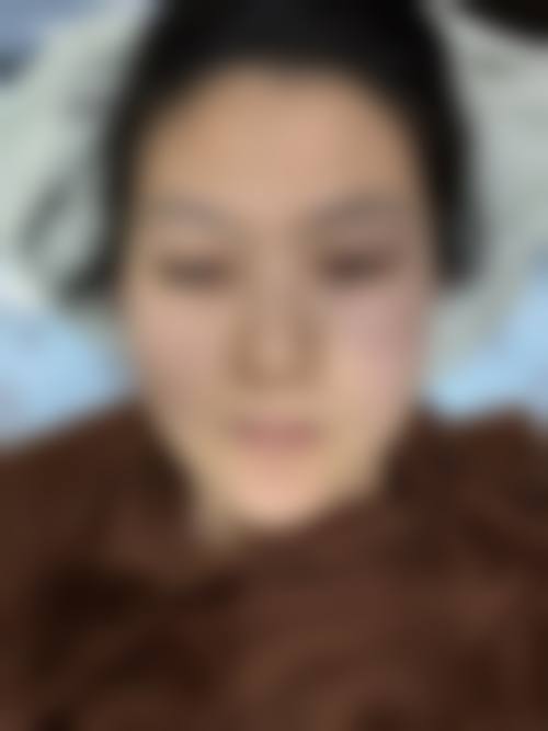 四、锦州瑰肤润医疗美容诊所特色项目