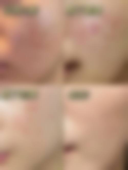 四、郑州美科医疗整形特色项目