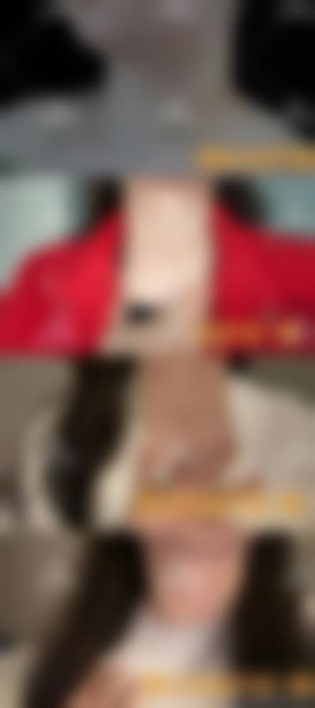 六、济南伊美尔加禾植发连锁机构价格表