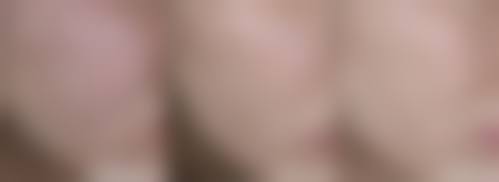 三、铜仁华医皮肤病医院整形科诊疗项目有哪些？