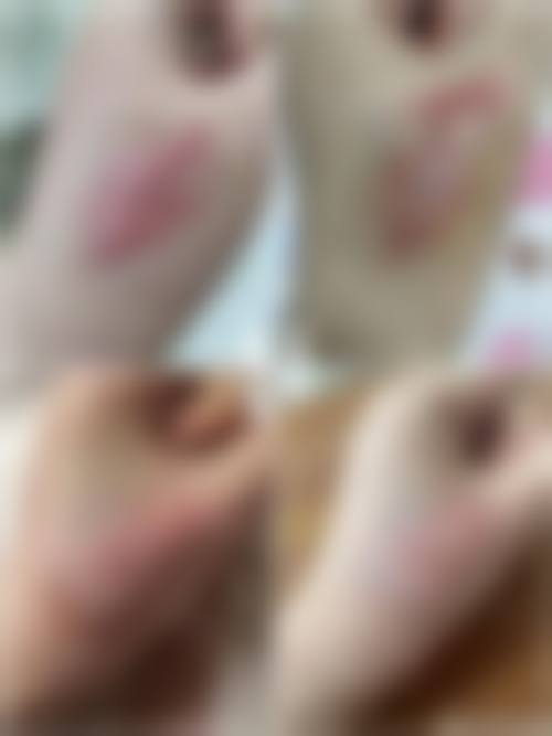 九、深圳尚虹医疗美容门诊部真实的患者评价