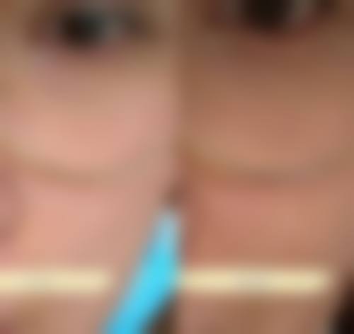 四、宁夏中卫薇悦美医疗美容诊所特色项目