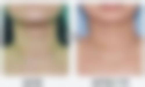 三、深圳尚虹医疗美容门诊部诊疗项目有哪些?