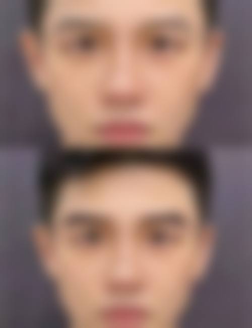 八、锦州瑰肤润医疗美容诊所真实的患者评价