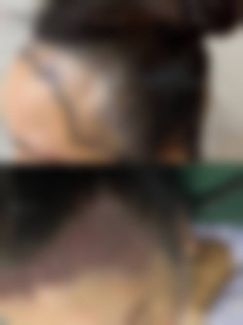 三、成都高新蓉创臻美整形医院诊疗项目有哪些?