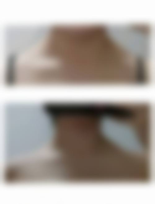 八、铜仁华医皮肤病医院整形科真实的患者评价