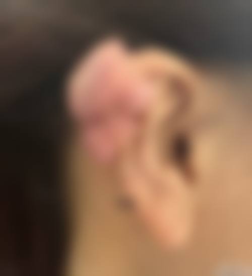 四、铜仁华医皮肤病医院整形科特色项目