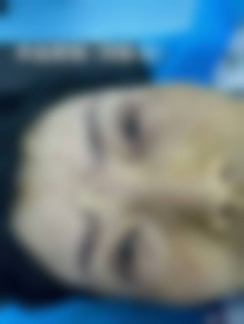 二、青岛市立整形医院怎么样？