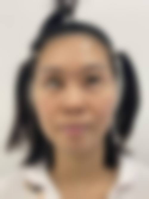 三、重庆颜轻医疗美容诊疗项目有哪些?