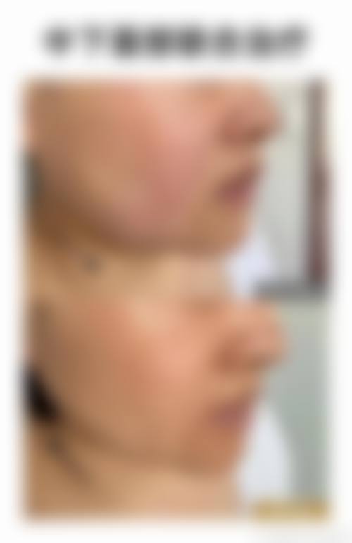 八、郑州美科医疗整形预约方式