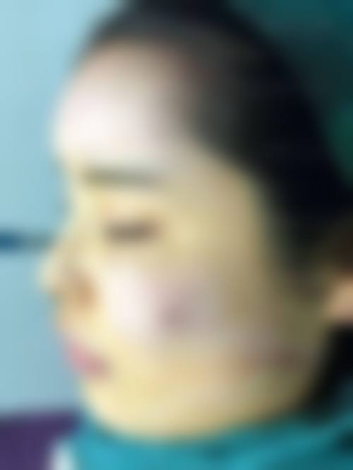 八、海拉尔绣颜挚美医疗美容门诊部预约方式