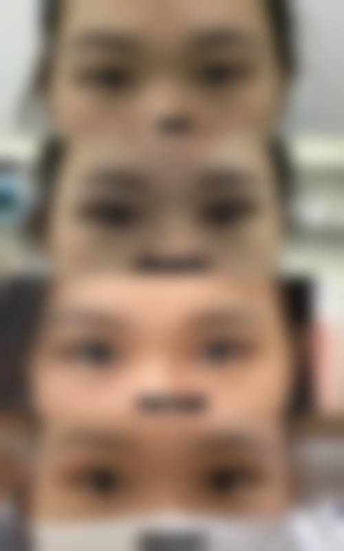 九、郑州美科医疗整形真实的患者评价