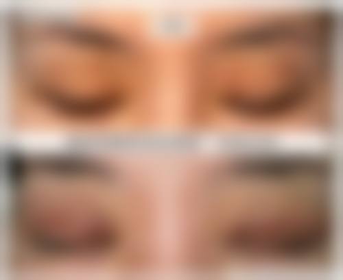 九、青岛市立整形医院真实的患者评价