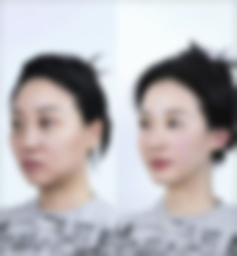 二、郑州美科医疗整形怎么样?