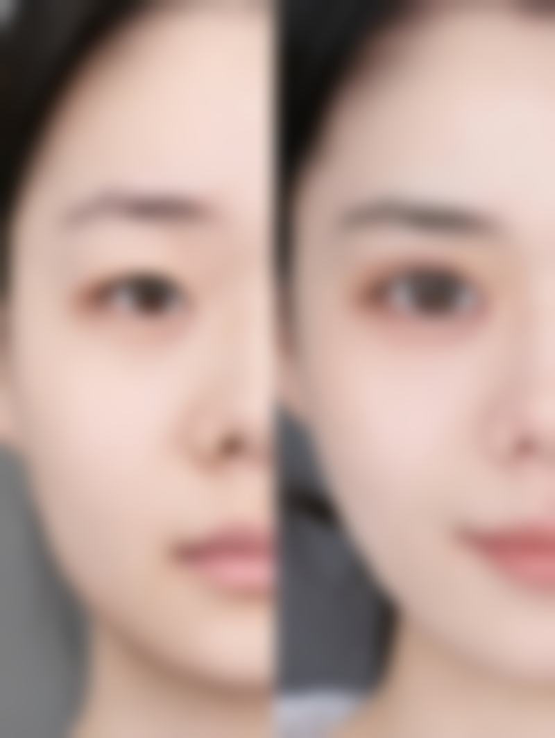 四、成都高新蓉创臻美整形医院特色项目