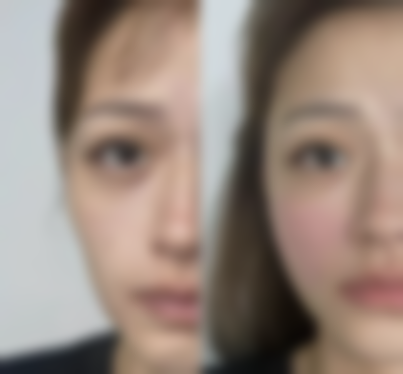 二、东莞莞城环球美天整形医院怎么样？