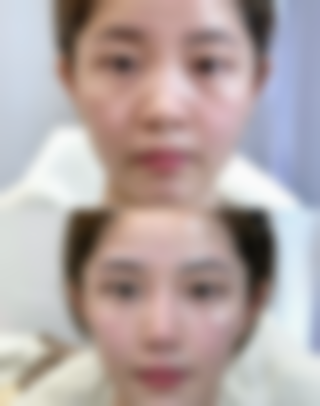 八、东莞莞城环球美天整形医院真实的患者评价