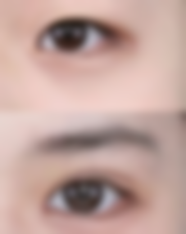 五、东莞莞城环球美天整形医院价格表