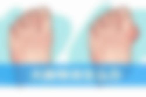 哪做双眼皮的手术好一点？三甲、专科等医院及优质医生为你打造理想双眸 