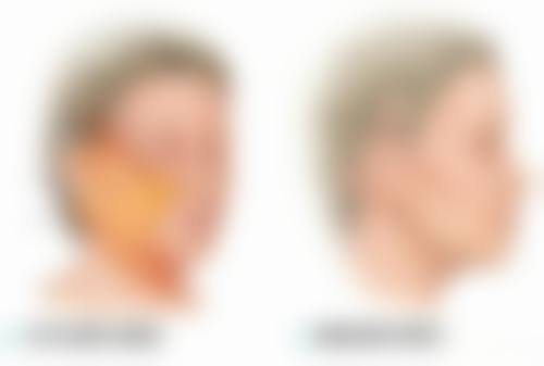 二、有没有除皱的化妆品之雅诗兰黛小棕瓶精华