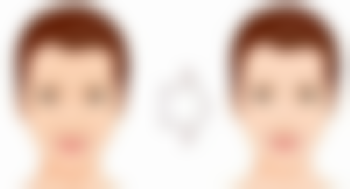 眼袋有泪沟是什么原因?总结与建议