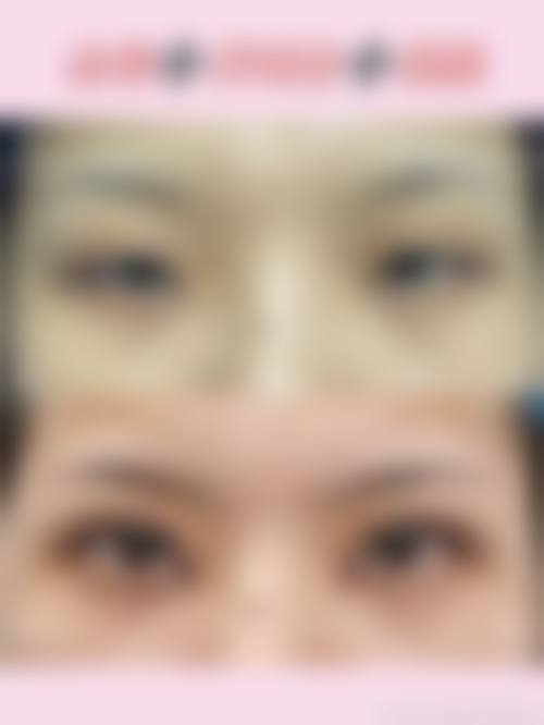 五、崔俊英怎么预约？