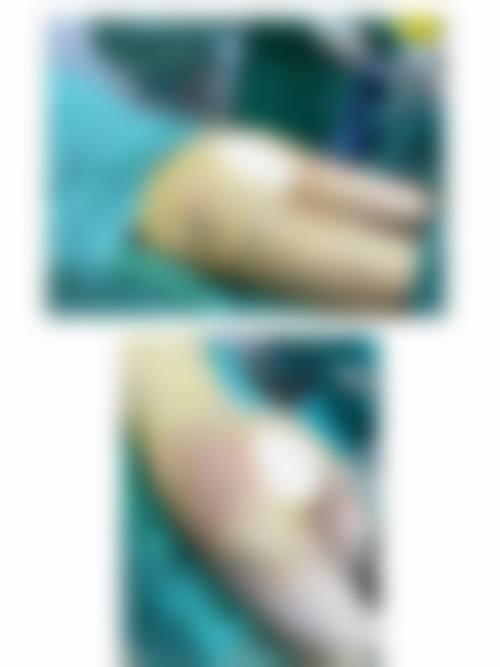 六、崔俊英真实的患者评价